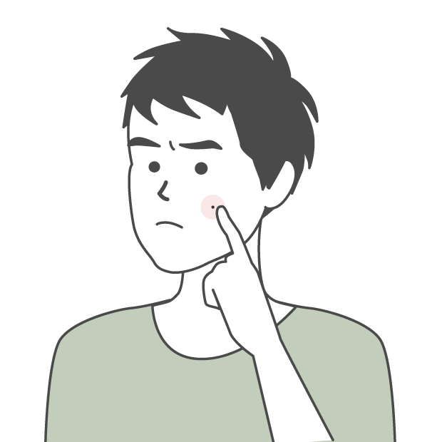 粉瘤イメージ