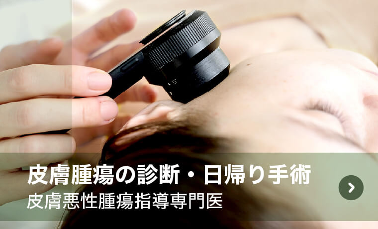 皮膚腫瘍の診断・日帰り手術｜皮膚悪性腫瘍指導専門医
